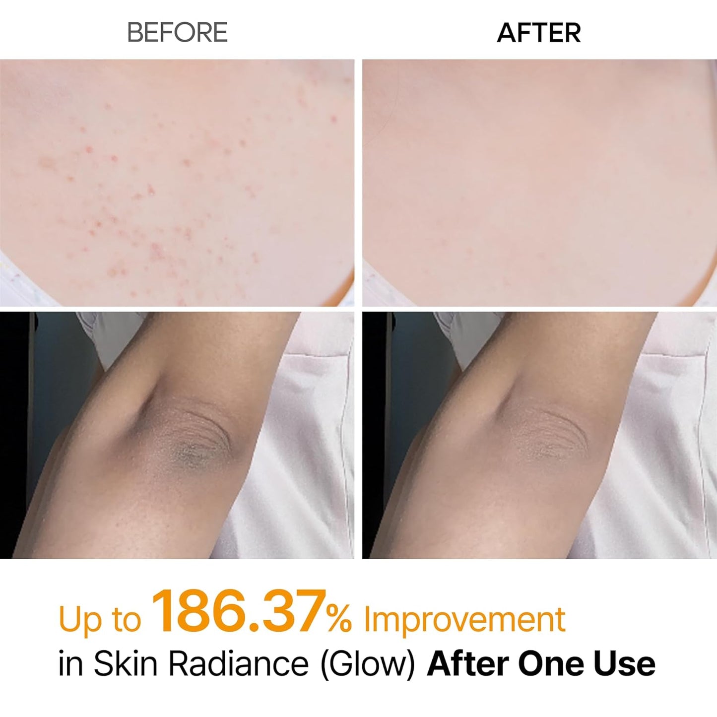 Dr.Melaxin Body Keratin Care Kojic Acid Turmeric Spray