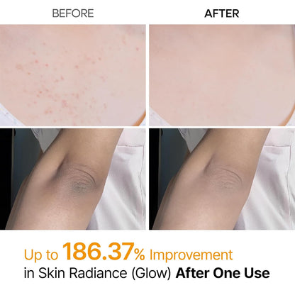 Dr.Melaxin Body Keratin Care Kojic Acid Turmeric Spray